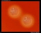 Streptococcus agalactiae